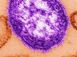 Group working to keep measles away from KC