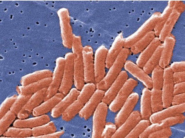 Kosher chicken linked to deadly salmonella outbreak